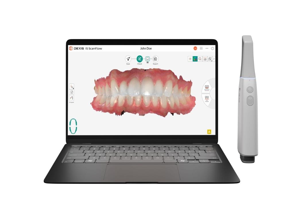 DEXIS iS ScanFlow software showing a 3D digital dental scan on a laptop alongside the intraoral scanner wand